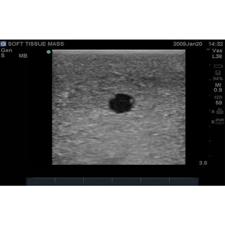 Breast Biopsy Ultrasound Training Model BPB170 | Sim & Skills