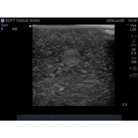 Breast Biopsy Ultrasound Training Model BPB170 | Sim & Skills