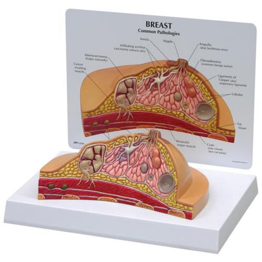 Breast Cross-Section Model 1019559 | Sim & Skills