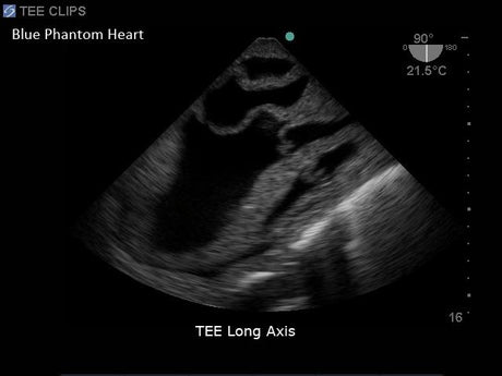 Cardiac Echo Ultrasound Training Model BPH700 | Sim & Skills