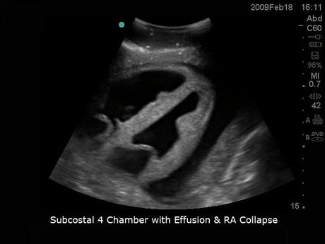 Cardiac Echo Ultrasound Training Model BPH700 | Sim & Skills