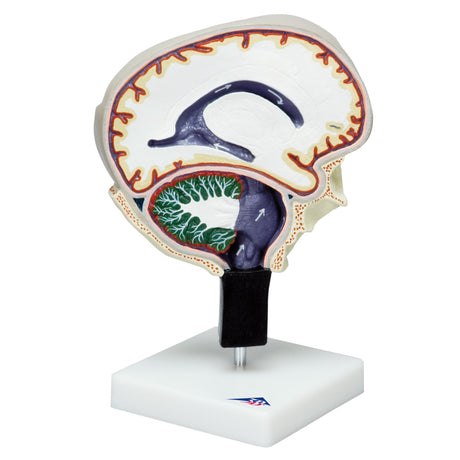 Cerebrospinal Fluid Circulation 1005114 | Sim & Skills