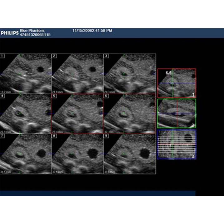 Combination IUP Ectopic Pregnancy Transvaginal Ultrasound Training Model BPOB1227 | Sim & Skills