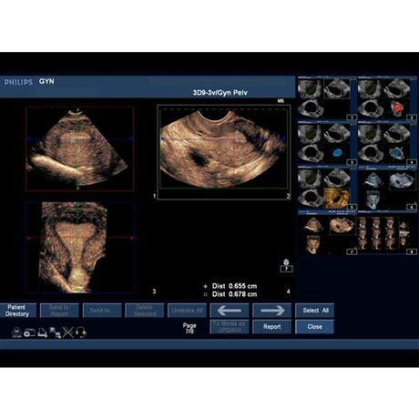 Combination IUP Ectopic Pregnancy Transvaginal Ultrasound Training Model BPOB1227 | Sim & Skills