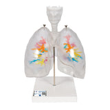 CT Bronchial Tree Model with Larynx & Transparent Lungs 1000275 | Sim & Skills