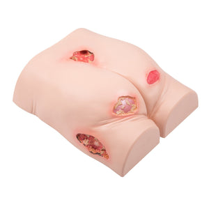 Decubitus Trainer | Pressure Ulcer Training Model