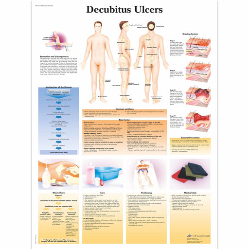 Decubitus Ulcers Chart Laminated Chart | Sim & Skills