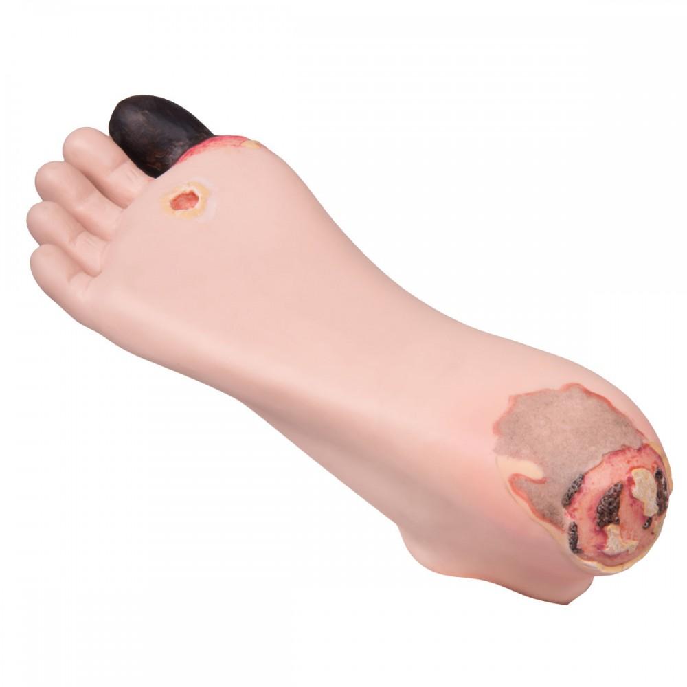 Diabetic Foot Treatment Trainer 1018815 | Sim & Skills