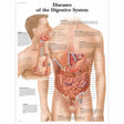 Diseases of the Digestive System Laminated Chart 1001548 | Sim & Skills