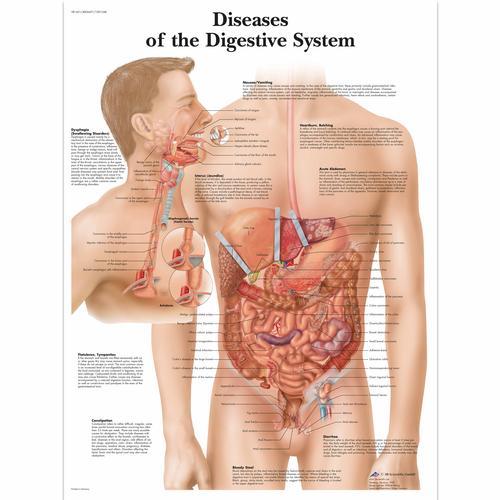 Diseases of the Digestive System Laminated Chart 1001548 | Sim & Skills
