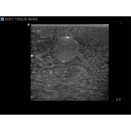 Elastography Ultrasound Breast Phantom BP1901 | Sim & Skills