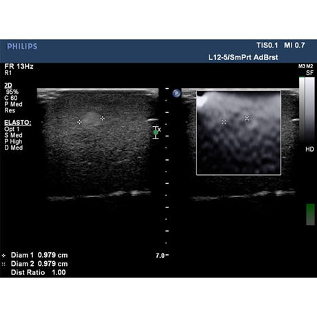 Elastography Ultrasound Breast Phantom BP1901 | Sim & Skills