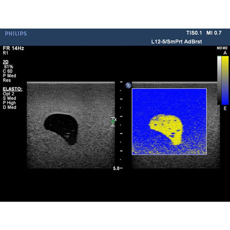 Elastography Ultrasound Breast Phantom BP1901 | Sim & Skills