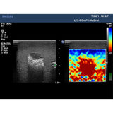 Elastography Ultrasound Breast Phantom BP1901 | Sim & Skills