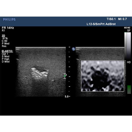 Elastography Ultrasound Breast Phantom BP1901 | Sim & Skills