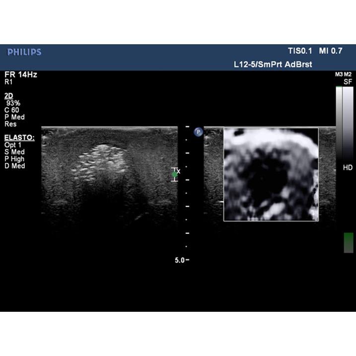 Elastography Ultrasound Breast Phantom BP1901 | Sim & Skills