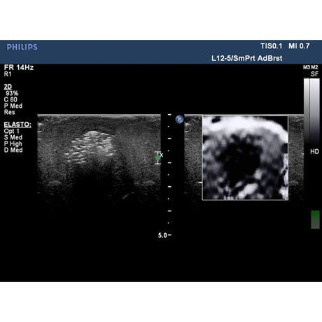 Elastography Ultrasound Breast Phantom BP1901 | Sim & Skills