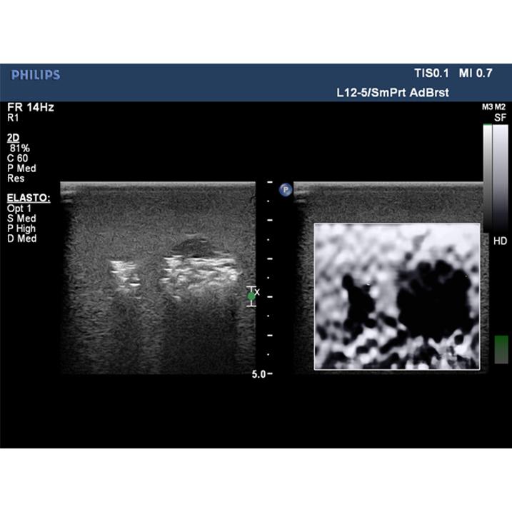 Elastography Ultrasound Breast Phantom BP1901 | Sim & Skills