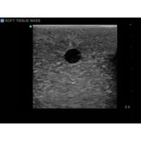 Elastography Ultrasound Breast Phantom BP1901 | Sim & Skills