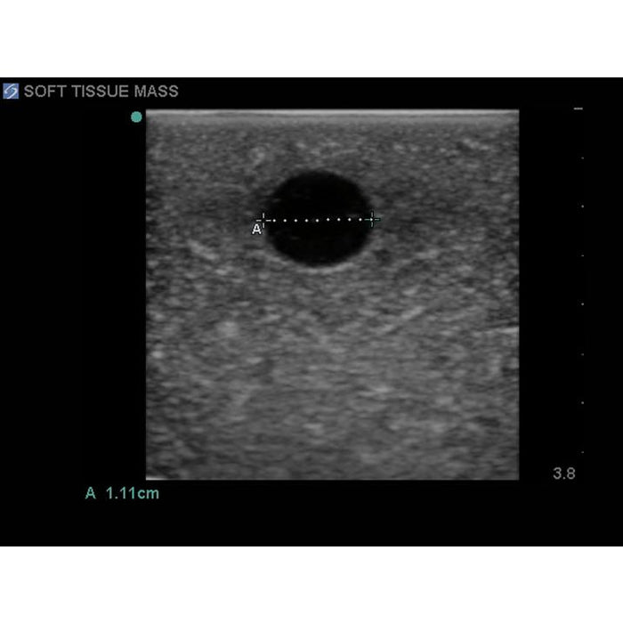 Elastography Ultrasound Breast Phantom BP1901 | Sim & Skills