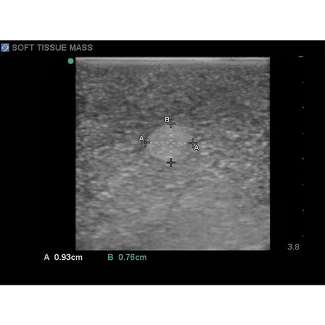 Elastography Ultrasound Breast Phantom BP1901 | Sim & Skills