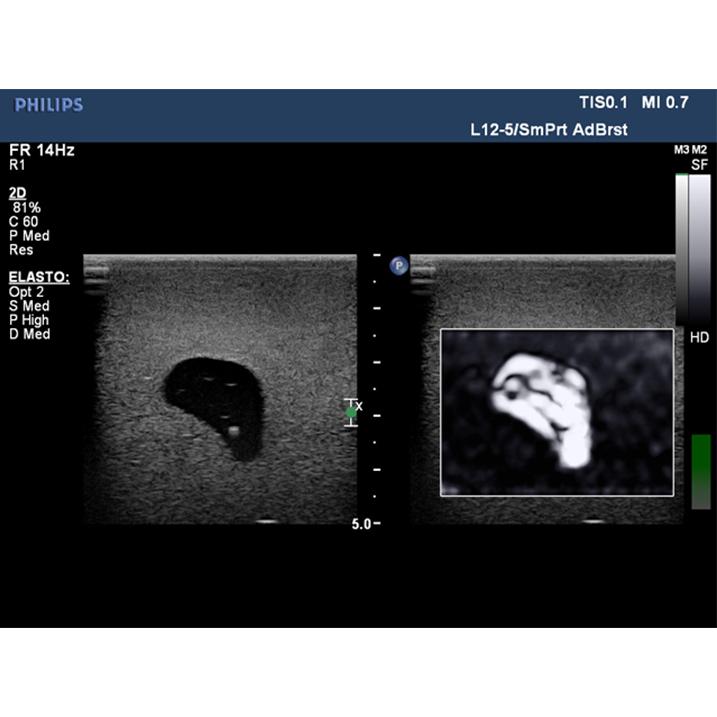 Elastography Ultrasound Breast Phantom BP1901 | Sim & Skills