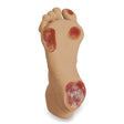 Elderly Pressure Ulcer Foot Model LF00933 | Sim & Skills