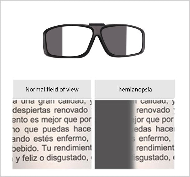 Eye Conditions Simulator SS1020 | Sim & Skills