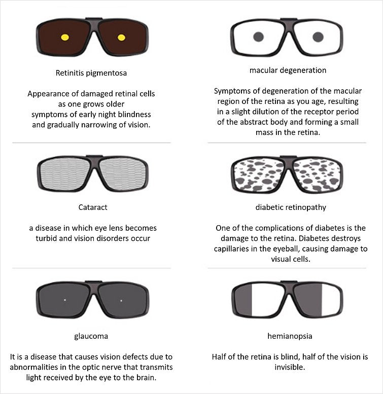 Eye Conditions Simulator SS1020 | Sim & Skills