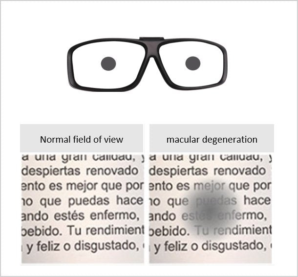 Eye Conditions Simulator SS1020 | Sim & Skills