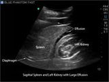 FAST, TTE and Pericardiocentesis Ultrasound Training Model BP-FAST1800 | Sim & Skills