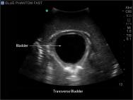 FAST, TTE and Pericardiocentesis Ultrasound Training Model BP-FAST1800 | Sim & Skills