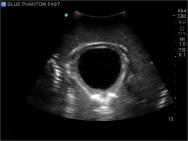FAST, TTE and Pericardiocentesis Ultrasound Training Model BP-FAST1800 | Sim & Skills