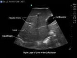 FAST, TTE and Pericardiocentesis Ultrasound Training Model BP-FAST1800 | Sim & Skills