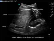 FAST, TTE and Pericardiocentesis Ultrasound Training Model BP-FAST1800 | Sim & Skills