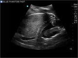 FAST, TTE and Pericardiocentesis Ultrasound Training Model BP-FAST1800 | Sim & Skills