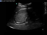 FAST, TTE and Pericardiocentesis Ultrasound Training Model BP-FAST1800 | Sim & Skills