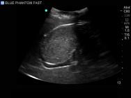 FAST, TTE and Pericardiocentesis Ultrasound Training Model BP-FAST1800 | Sim & Skills