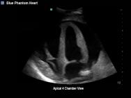 FAST, TTE and Pericardiocentesis Ultrasound Training Model BP-FAST1800 | Sim & Skills