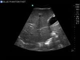 FAST, TTE and Pericardiocentesis Ultrasound Training Model BP-FAST1800 | Sim & Skills