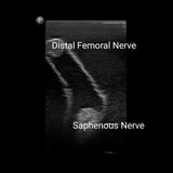 Gen II Femoral Vascular Access and Regional Anaesthesia Ultrasound Training Model BPF1500-HP | Sim & Skills