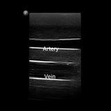 Gen II Femoral Vascular Access and Regional Anaesthesia Ultrasound Training Model BPF1500-HP | Sim & Skills