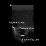 Gen II Femoral Vascular Access and Regional Anaesthesia Ultrasound Training Model BPF1500-HP | Sim & Skills