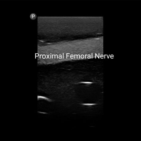 Gen II Femoral Vascular Access and Regional Anaesthesia Ultrasound Training Model BPF1500-HP | Sim & Skills