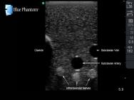 Gen II Regional Anaesthesia and Central Line Ultrasound Training Model BPHNB670-HP | Sim & Skills