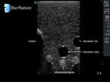 Gen II Regional Anaesthesia and Central Line Ultrasound Training Model BPHNB670-HP | Sim & Skills