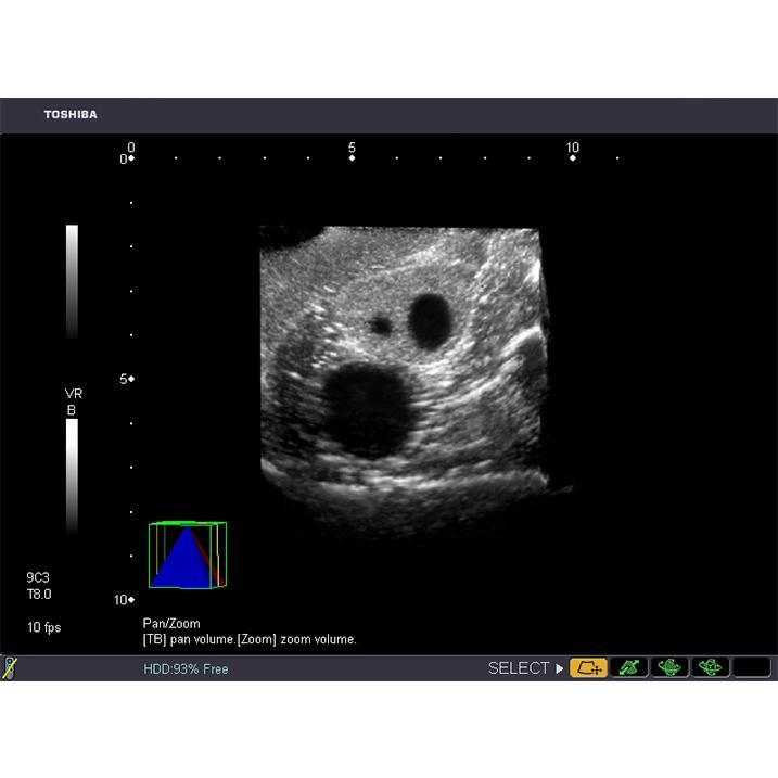 General Pathology Transvaginal Ultrasound Training Model BPOB1220 | Sim & Skills
