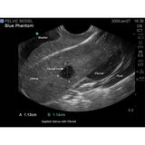 General Pathology Transvaginal Ultrasound Training Model BPOB1220 | Sim & Skills