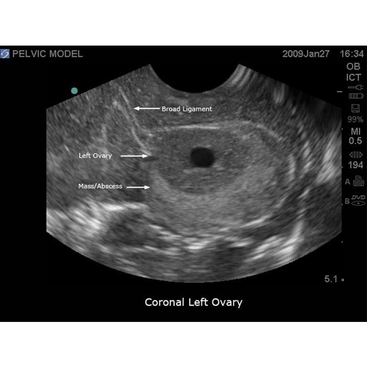 General Pathology Transvaginal Ultrasound Training Model BPOB1220 | Sim & Skills