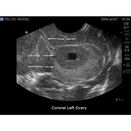 General Pathology Transvaginal Ultrasound Training Model BPOB1220 | Sim & Skills